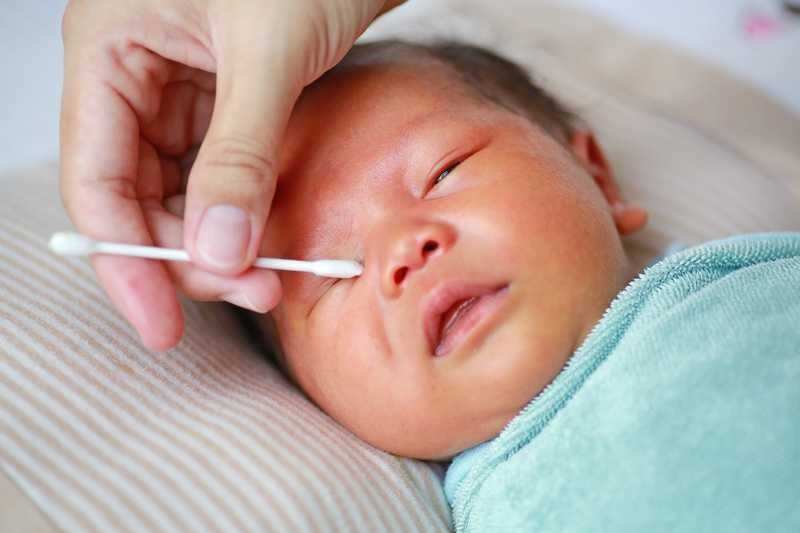 membersihkan mata bayi, cairan mata bayi, cara membersihkan mata bayi, kesehatan mata bayi, konjungtivitis pada bayi , Bunda, si Kecil 